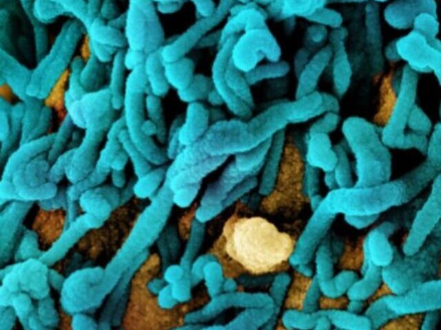 Microscopic image of SARS-CoV-2 (COVID-19) virus.