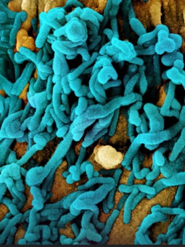 Pesticides Alter Gut Bacteria: 306 Interactions Mapped