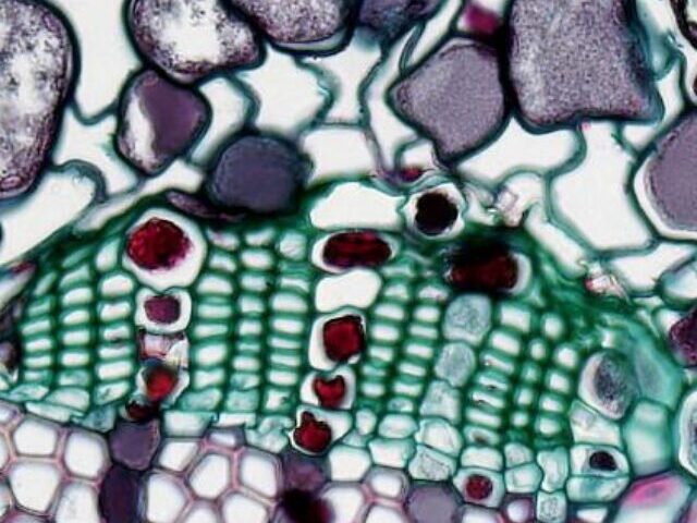 Stanford Breakthrough Single Molecule Boosts Aging Muscle Strength 15-20% in One Month.Photo Source: Fayette Reynolds M.S. Representative Image.