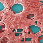 Representative Image. Legionella pneumophila. Photo Source:: Wikimedia Commons
