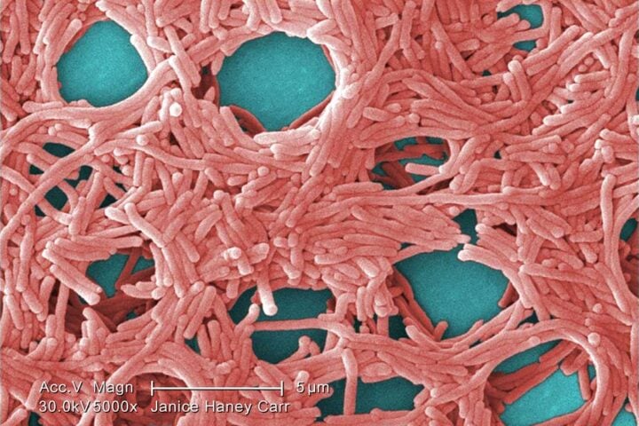 Representative Image. Legionella pneumophila. Photo Source:: Wikimedia Commons