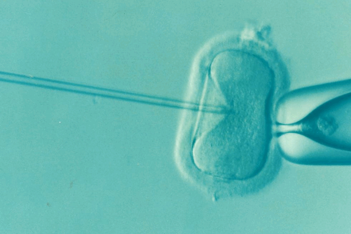 IVF