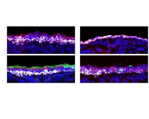 Damage from smoke and respiratory viruses mitigated in mice via a common signaling pathway.