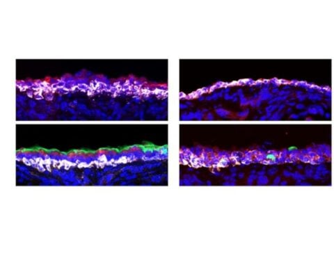 Damage from smoke and respiratory viruses mitigated in mice via a common signaling pathway. Photo Source: Stanford Medicine