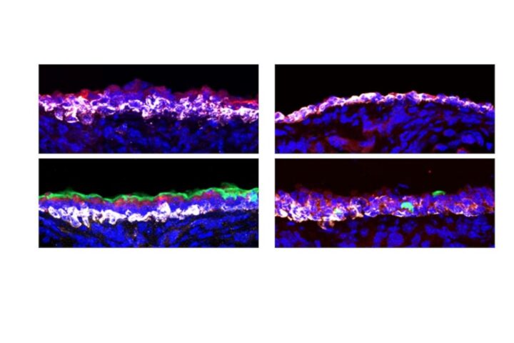 Damage from smoke and respiratory viruses mitigated in mice via a common signaling pathway.