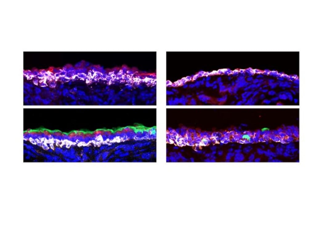 Basal stem cells in airways of normal mice. Photo Source: Stanford Medicine