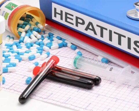 Hepatitis