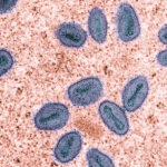Colorized transmission electron micrograph of mpox virus particles (purple and teal) found within an infected cell (brown), cultured in the laboratory. Credit: NIAID (CC BY 2.0)
