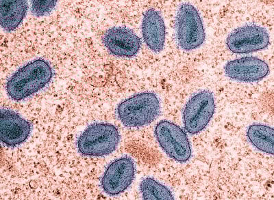 Colorized transmission electron micrograph of mpox virus particles (purple and teal) found within an infected cell (brown), cultured in the laboratory. Credit: NIAID (CC BY 2.0)
