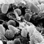 Yersinia Pestis