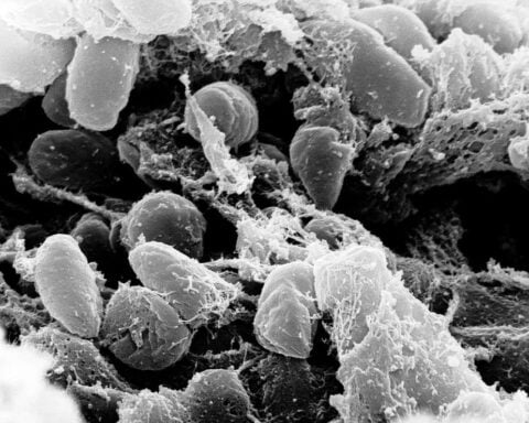 Yersinia Pestis