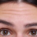 Close-up of a woman’s forehead with faint horizontal wrinkles as a finger touches the left temple area.
