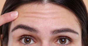 Close-up of a woman’s forehead with faint horizontal wrinkles as a finger touches the left temple area.