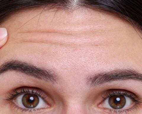 Close-up of a woman’s forehead with faint horizontal wrinkles as a finger touches the left temple area.