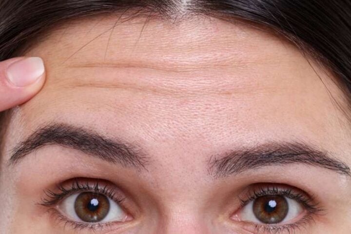 Close-up of a woman’s forehead with faint horizontal wrinkles as a finger touches the left temple area.