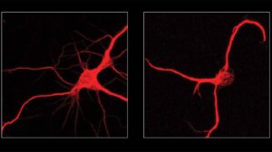 Fluorescent microscopy images comparing two neurons: left shows a healthy neuron with multiple branching extensions, right shows a neuron with fewer, simpler extensions after FTL1 protein exposure.