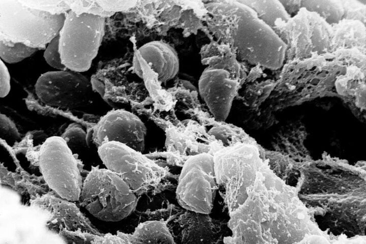Scanning electron micrograph showing rod-shaped Yersinia pestis bacteria, the causative agent of plague, at high magnification.