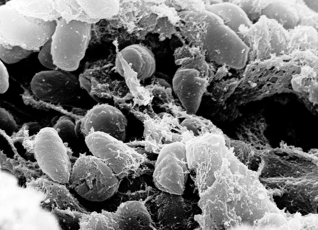 Scanning electron micrograph showing rod-shaped Yersinia pestis bacteria, the causative agent of plague, at high magnification.