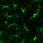 Fluorescent microglial cells engrafted into a mouse brain, visualized to demonstrate successful cell replacement in a neurodegeneration model.
