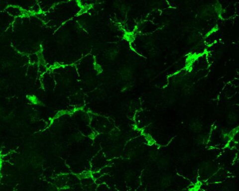 Fluorescent microglial cells engrafted into a mouse brain, visualized to demonstrate successful cell replacement in a neurodegeneration model.