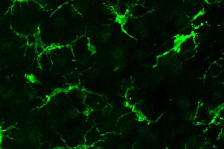 Fluorescent microglial cells engrafted into a mouse brain, visualized to demonstrate successful cell replacement in a neurodegeneration model.