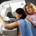 A healthcare professional assists an Asian woman positioning herself for a mammogram screening, demonstrating proper breast cancer screening procedure.