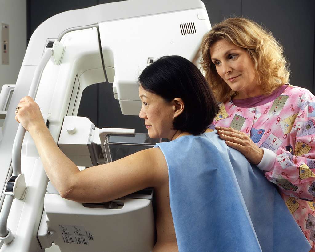 A healthcare professional assists an Asian woman positioning herself for a mammogram screening, demonstrating proper breast cancer screening procedure.