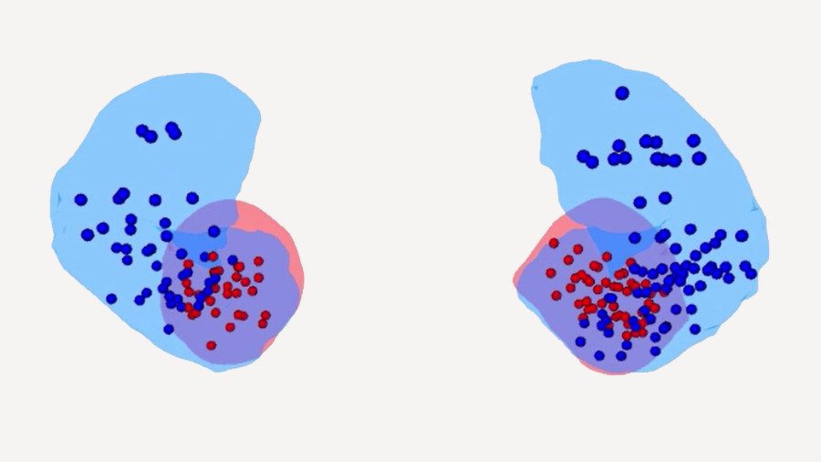 Brain electrode visualization showing blue and red dots representing electrode placements across two brain hemisphere views, with overlapping blue and red regions indicating the amygdala area where fear memory extinction signals were recorded.