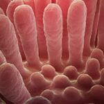 Microscopic view of inflamed intestinal villi showing the damaged, flattened mucous layer characteristic of celiac disease compared to healthy finger-like projections that normally absorb nutrients.