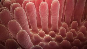 Microscopic view of inflamed intestinal villi showing the damaged, flattened mucous layer characteristic of celiac disease compared to healthy finger-like projections that normally absorb nutrients.