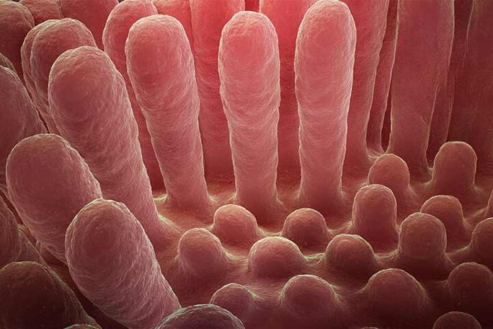 Microscopic view of inflamed intestinal villi showing the damaged, flattened mucous layer characteristic of celiac disease compared to healthy finger-like projections that normally absorb nutrients.