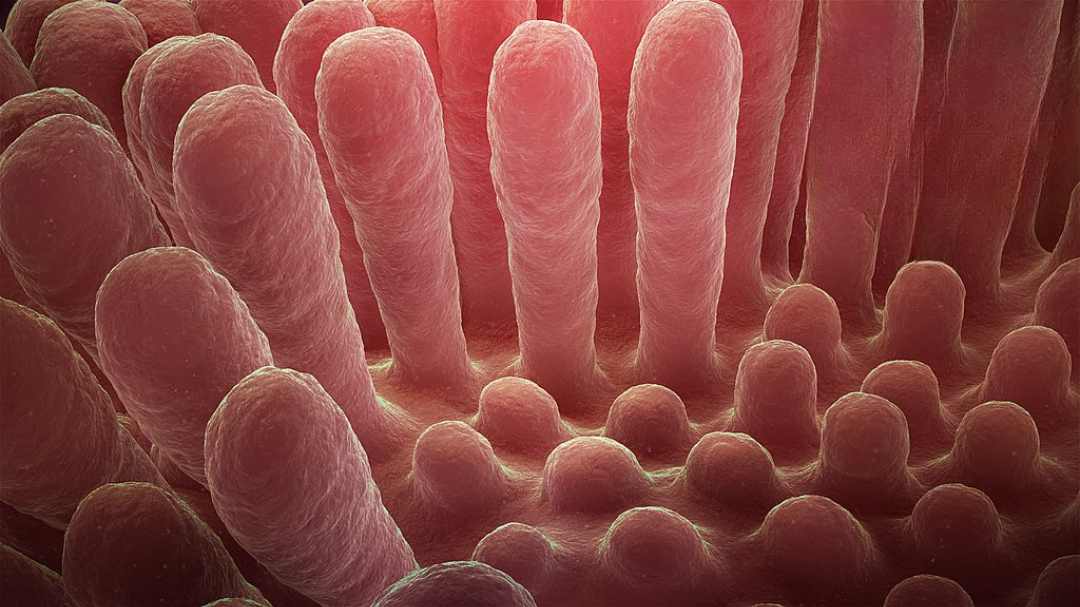 Microscopic view of inflamed intestinal villi showing the damaged, flattened mucous layer characteristic of celiac disease compared to healthy finger-like projections that normally absorb nutrients.
