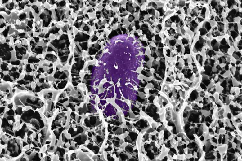 Microscopic image showing Salmonella bacteria (colored purple) trapped within the fibrous network structure of intestinal mucus.