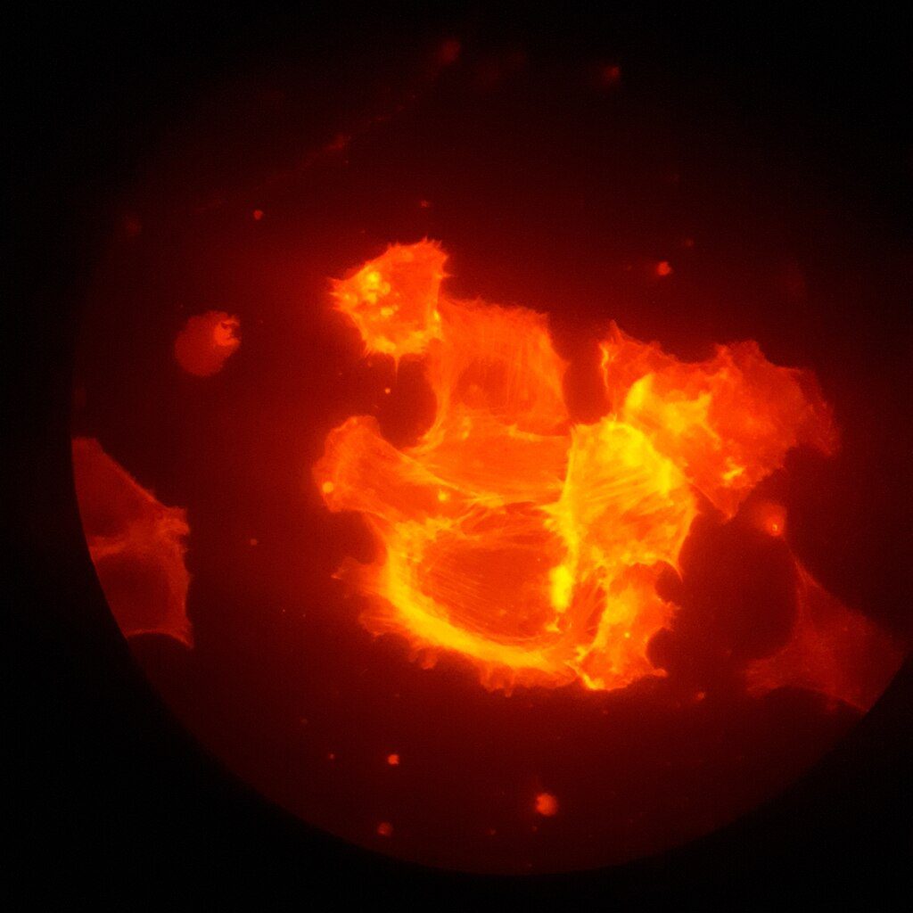 Fluorescent microscopy image of orange-red cancer cells growing in media containing ribohistatin, showing their clustered structure against a dark background.