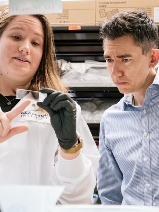 Brain Cells “Working Too Hard” Cause Parkinson’s Death