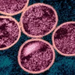 Colorized transmission electron micrograph of immature mpox virus particles (pink) within an infected VERO E6 cell (teal), NIAID, 2024.