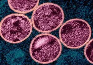 Colorized transmission electron micrograph of immature mpox virus particles (pink) within an infected VERO E6 cell (teal), NIAID, 2024.