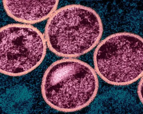 Colorized transmission electron micrograph of immature mpox virus particles (pink) within an infected VERO E6 cell (teal), NIAID, 2024.