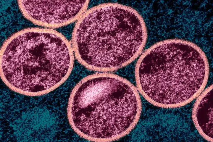 Colorized transmission electron micrograph of immature mpox virus particles (pink) within an infected VERO E6 cell (teal), NIAID, 2024.