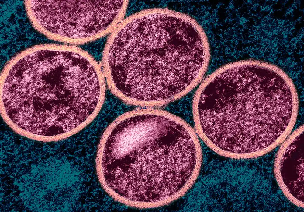 Colorized electron micrograph of immature mpox virus particles within infected cells (NIAID, CC BY 2.0)