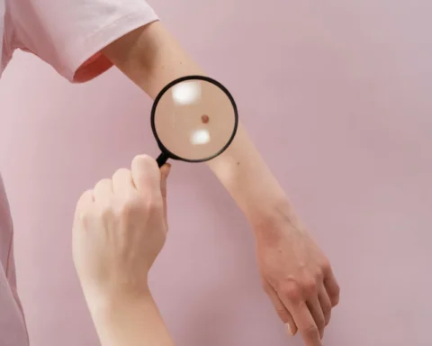 Person holding a magnifying glass over a white surface, symbolizing close examination and vigilance in detecting early skin changes.