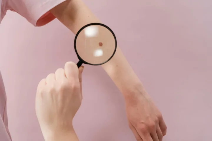 Person holding a magnifying glass over a white surface, symbolizing close examination and vigilance in detecting early skin changes.