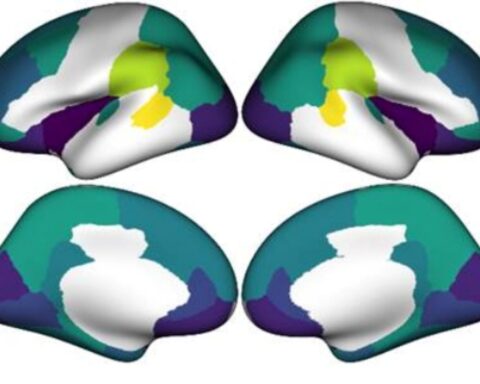 A scientific image displaying four different views of a human brain, color-coded to indicate varying cortical thickness. Darker colors represent areas with a greater reduction in cortical thickness, which is linked to societal income inequality.