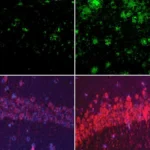 Fluorescence microscopy panels comparing Alzheimer’s mouse brain tissue show more amyloid-beta deposits and stronger tau staining when lithium is deficient versus normal levels. Harvard Medical School