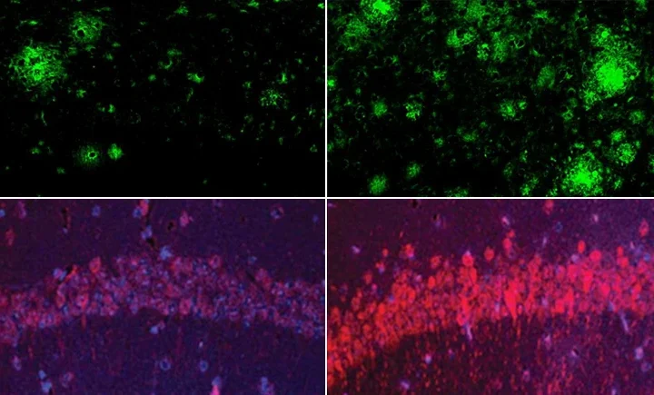 Fluorescence microscopy panels comparing Alzheimer’s mouse brain tissue show more amyloid-beta deposits and stronger tau staining when lithium is deficient versus normal levels. Harvard Medical School