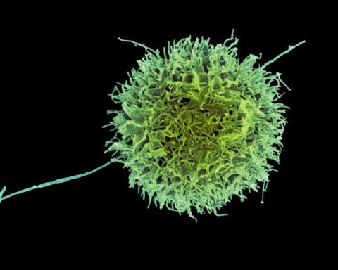 A vibrant green and yellow natural killer cell, magnified and detailed, showcasing its complex structure with tentacle-like extensions against a stark black background.