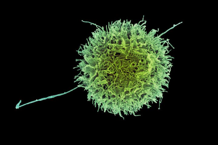 A vibrant green and yellow natural killer cell, magnified and detailed, showcasing its complex structure with tentacle-like extensions against a stark black background.