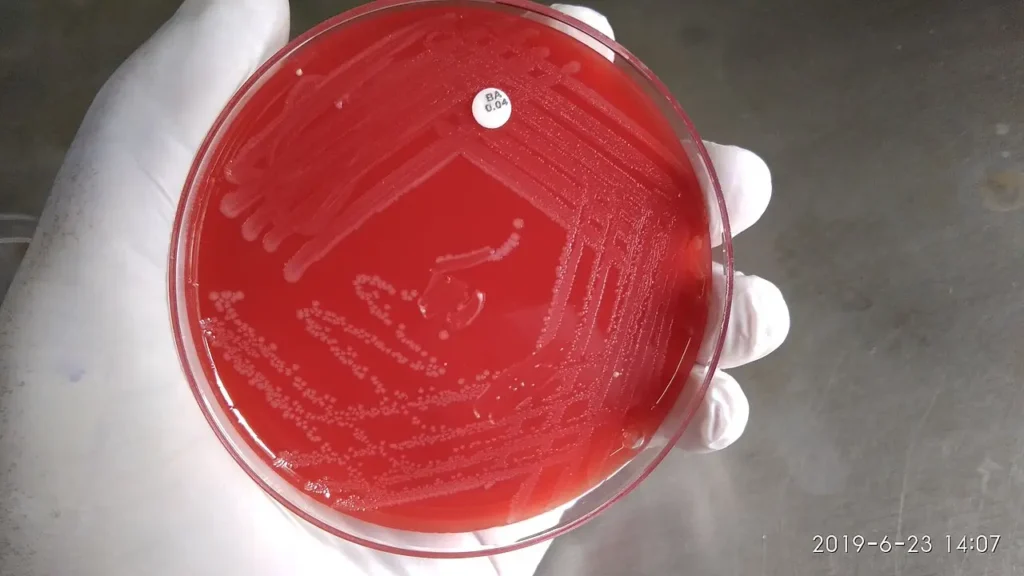 Gloved hand holding a red blood-agar petri dish showing streaked Listeria monocytogenes colonies.