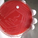 Gloved hand holding a red blood-agar petri dish showing streaked Listeria monocytogenes colonies.