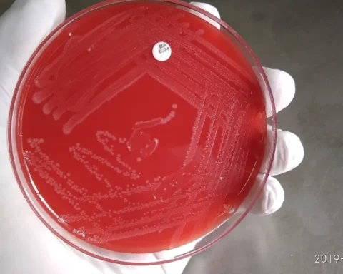 Gloved hand holding a red blood-agar petri dish showing streaked Listeria monocytogenes colonies.